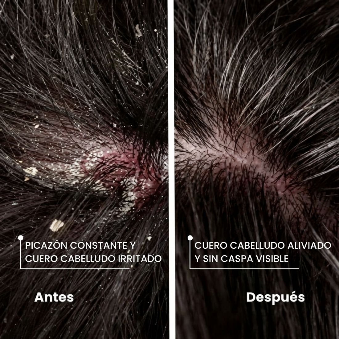 ANTI CASPA