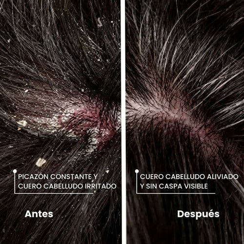 ANTI CASPA