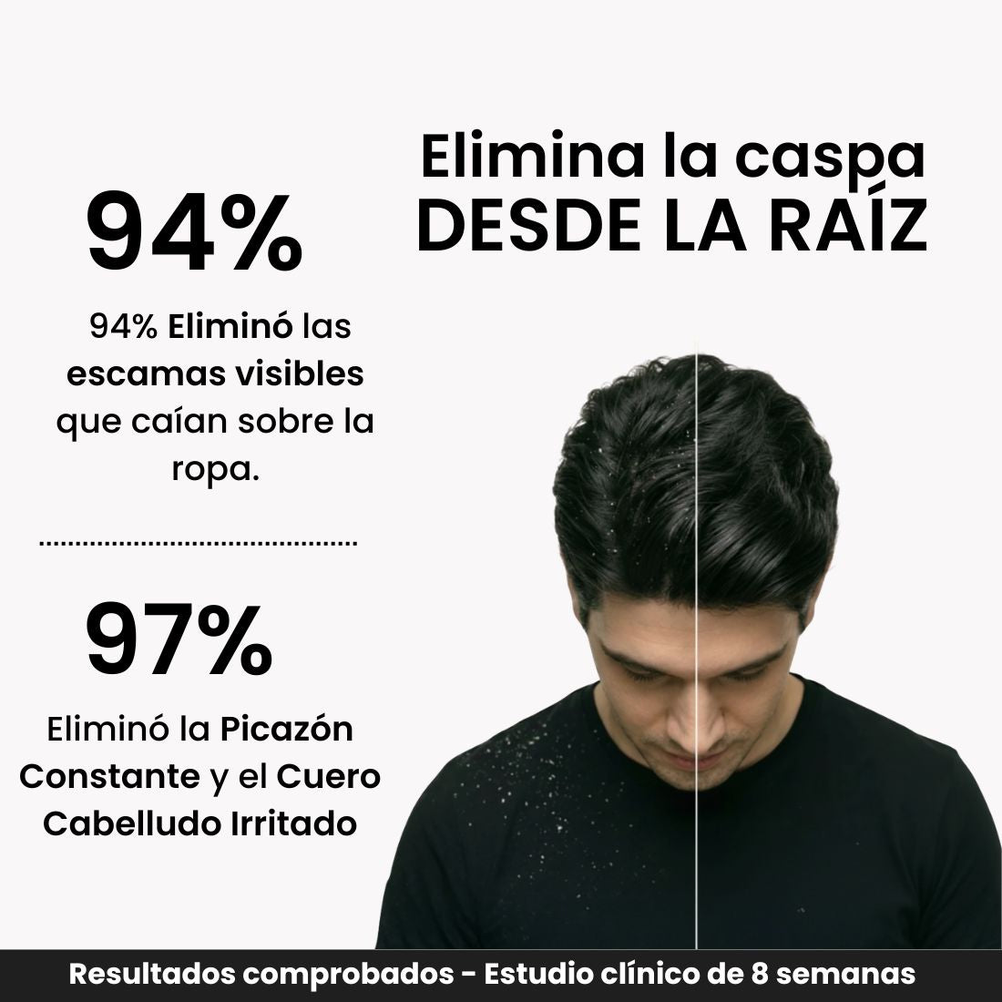 ANTI CASPA